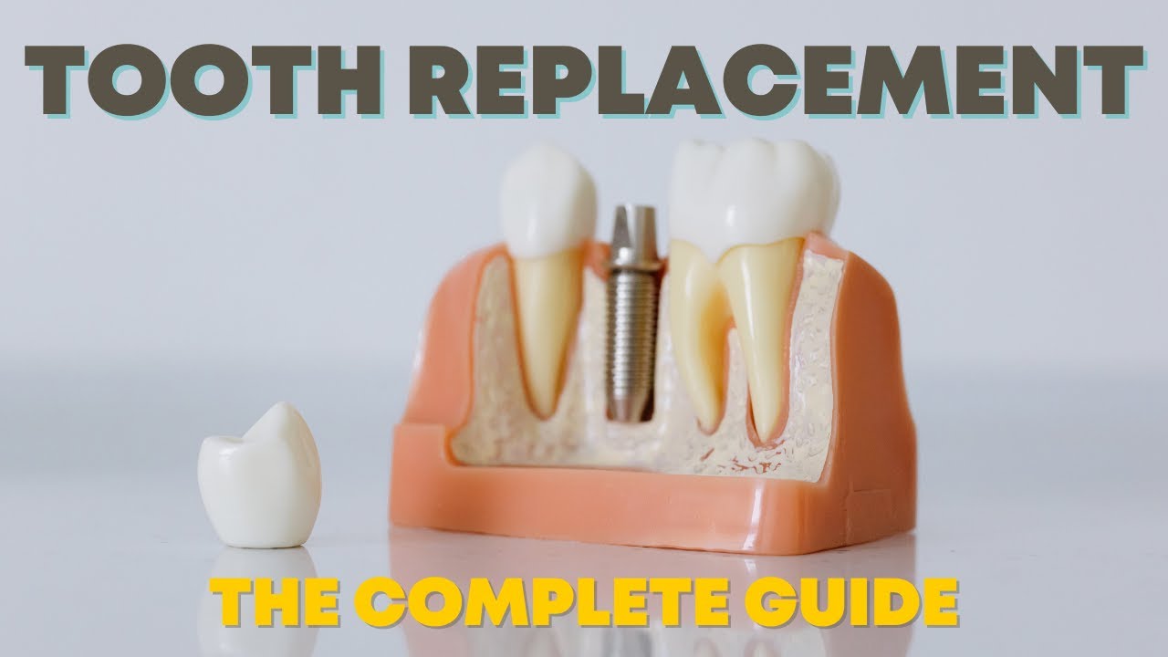 Missing Tooth Replacement 