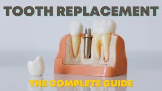The 4 Options You Must Know About Replacing Missing Teeth