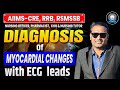AIMS-CRE, RRB, RSMSSB | ECG Lead Interpretation: Myocardial Changes &amp; Diagnosis