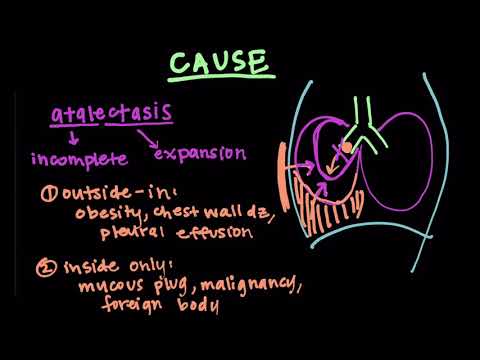 Video: Rozdíl Mezi Atelektázou A Pneumotoraxem