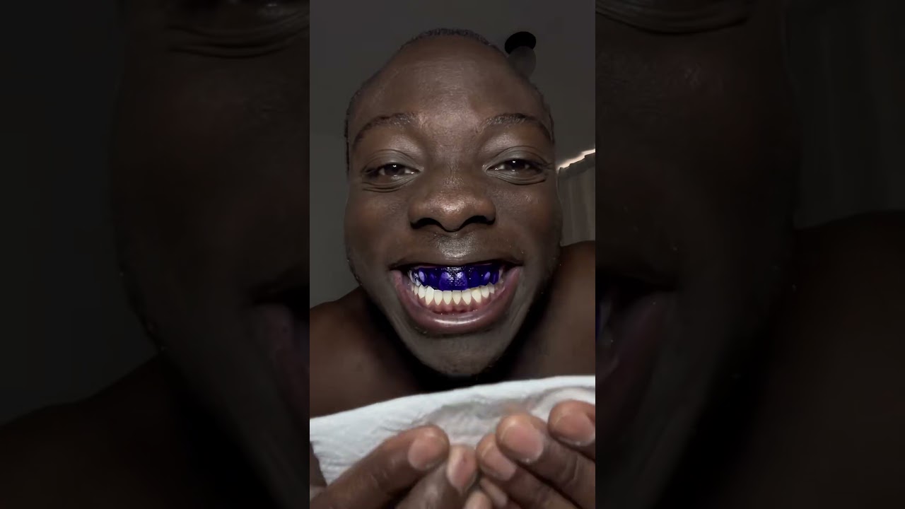 Glory Smil Kit