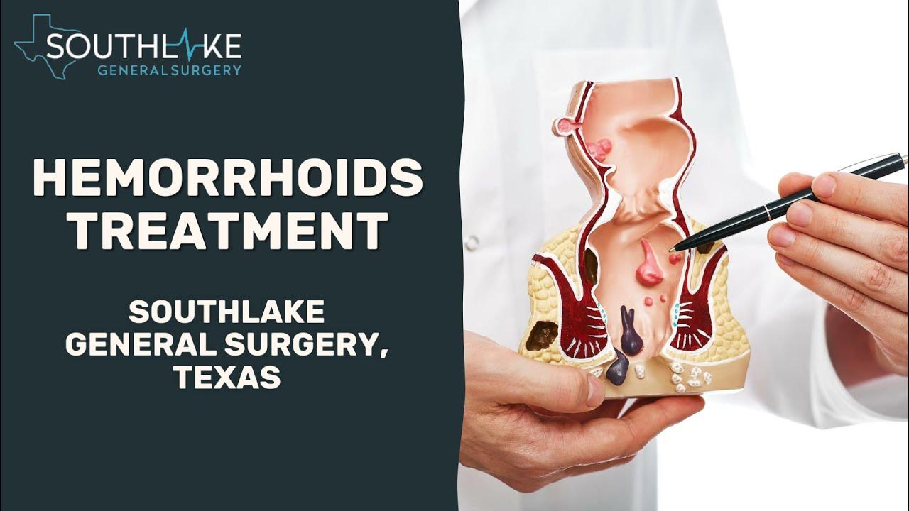 Hemorrhoids Treatment at Southlake General Surgery, Texas YouTube