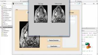 Comparison of Feature Extraction Techniques to classify Oral | Final Year Projects 2016 - 2017