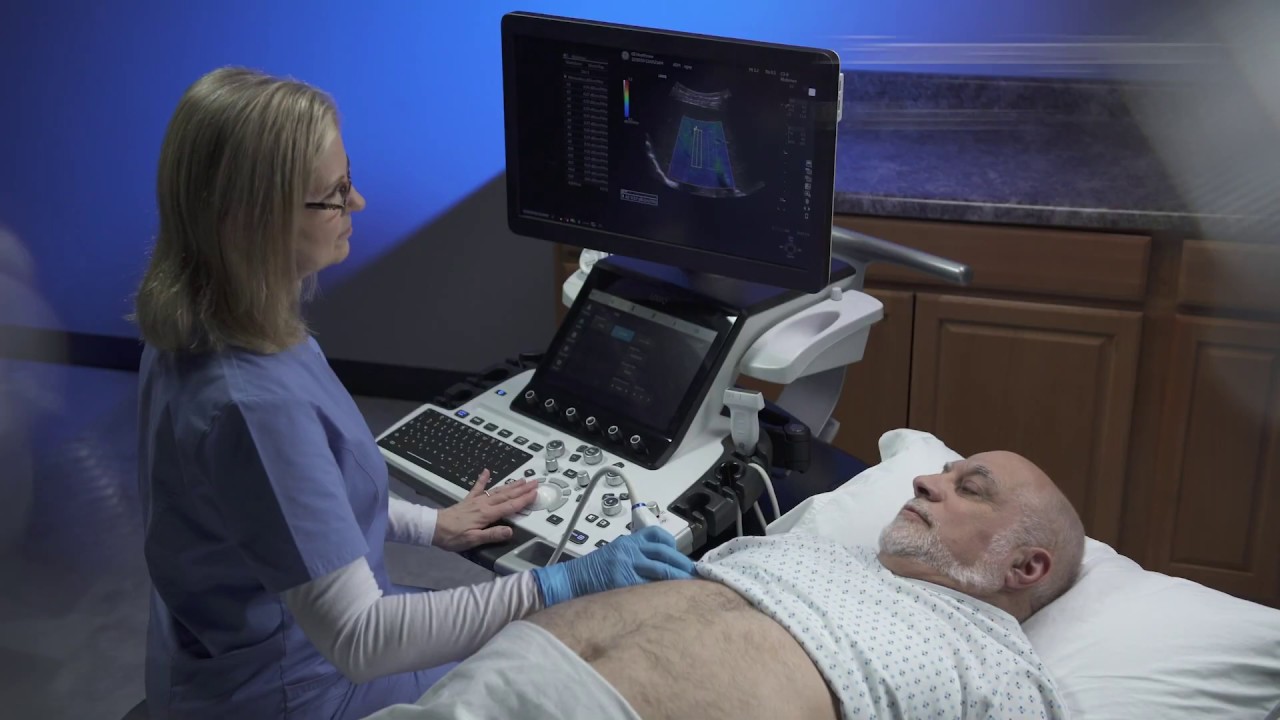 LOGIQ E10 Series Ultrasound with UltrasoundGuided Attenuation