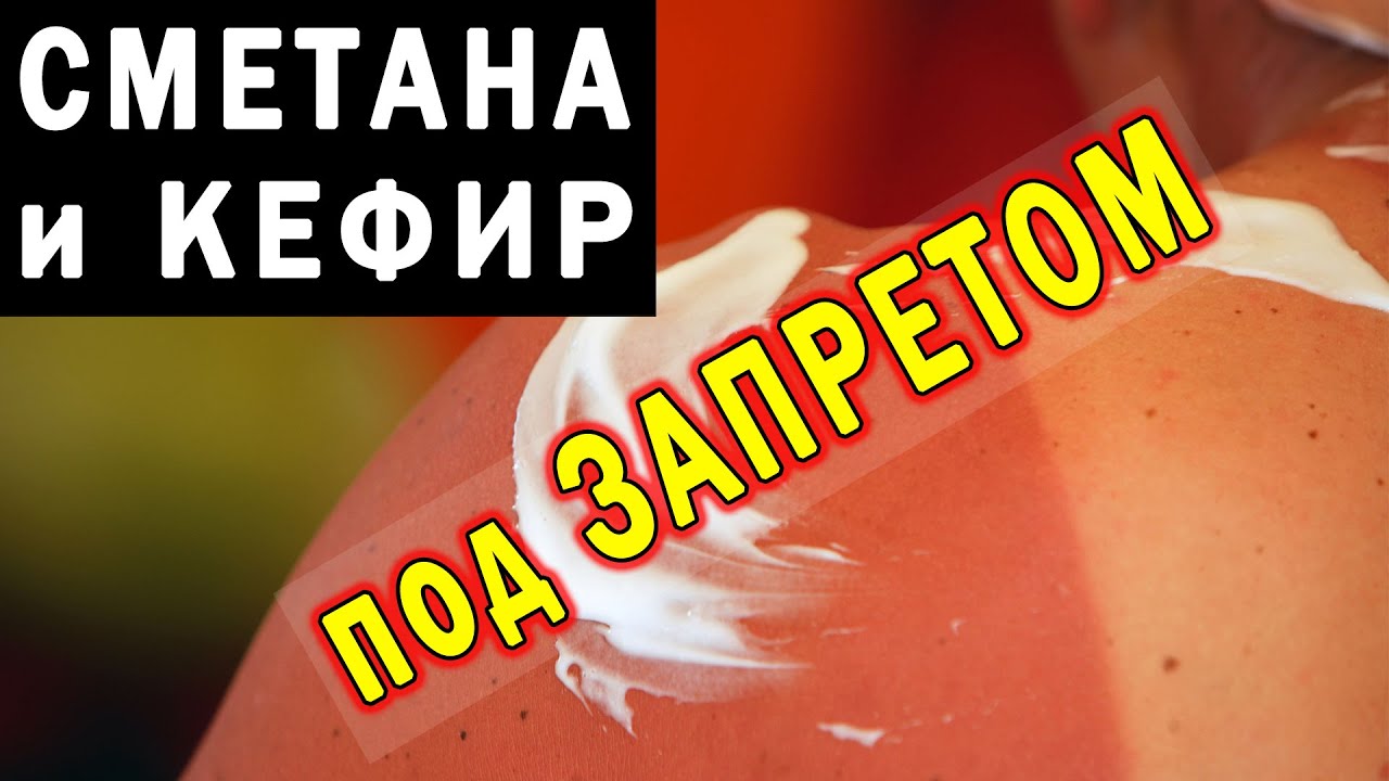 Врач рассказал, почему нельзя использовать сметану и кефир при солнечных ожогах: будет только хуже