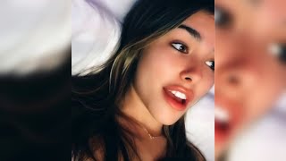 MADISON BEER SPEAKS OUT ABOUT PLASTIC SURGERY RUMORS (THE TRUTH)