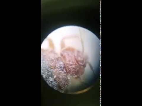 Kill bed bugs with Silica Gel. microscope zoom x 400   (no pesticide, they die within hours)