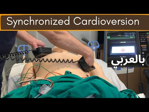 مزيل رجفان  القلب المتزامن [Synchronized Cardioversion]