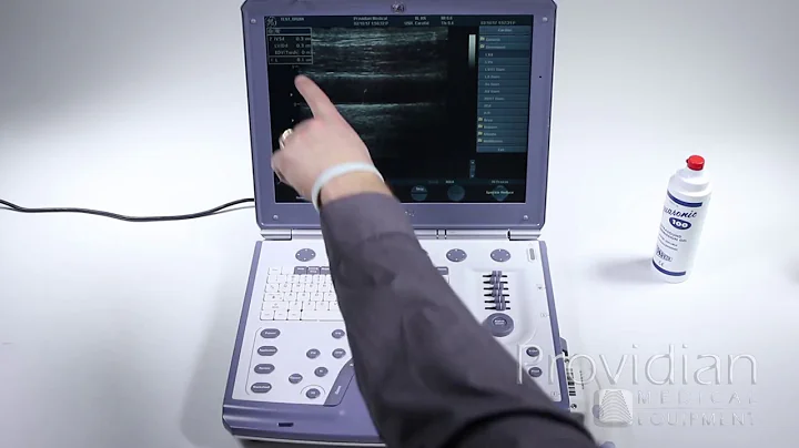 GE Vivid i Training Part 4: Calculations, Measurements and Comments