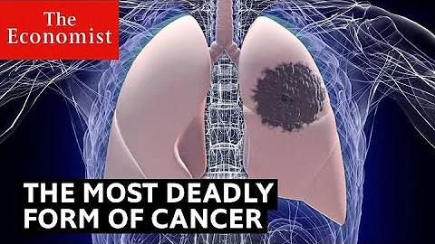 How to detect the deadliest form of cancer - DayDayNews