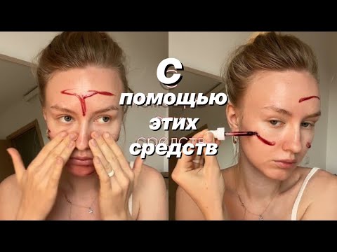 как я вылечила кожу - лучшие средства