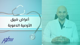 أعراض ضيق الأوعية الدموية