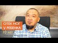 Отеки ног у ребенка | Отзыв отца Фатимы, Рустама