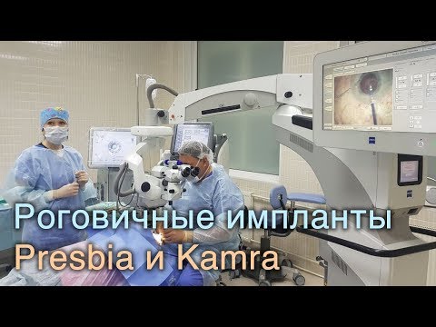 Имплантация роговичных вставок Presbia и Kamra