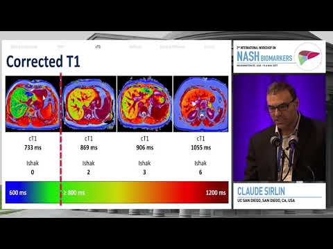 MRI; what can it deliver | Claude Sirlin, MD