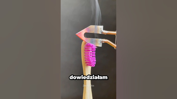 Moje Córki Były Zrośnięte W Jedno Ciało😱