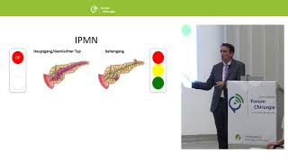 PANKREASZYSTEN: EPIDEMIOLOGIE, ZUFALLSBEFUNDE, MANAGEMEN