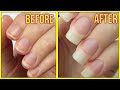 In Just 5 Minutes Grow Long Strong Beautiful Nails-Long Healthy Nails Tips