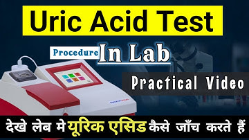 Uric Acid Test | Uric Acid Test Procedure In Lab
