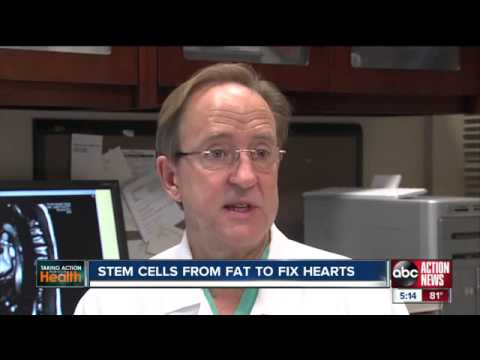 ATHENA Stem Cell Cardiac Trial