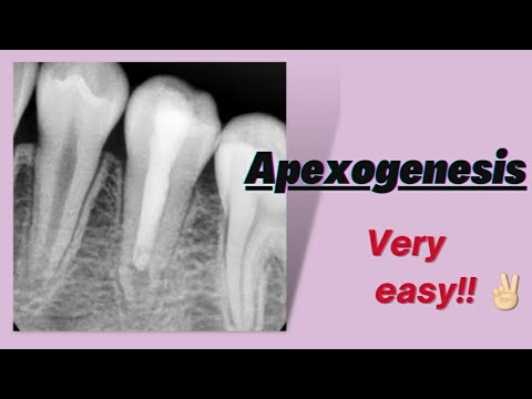 Apexogenesis