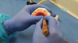 Impression trays 3 Wax relieve screenshot 4