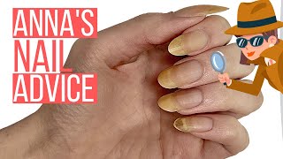 YELLOW NAILS & CRACKED NAIL. ANNA HELP!! [ANNA'S NAIL ADVICE] 🕵️‍♀️ screenshot 4