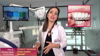Ortodonti Tedavisinde Braket Çeşitleri Nelerdir? - Trdoktorcom