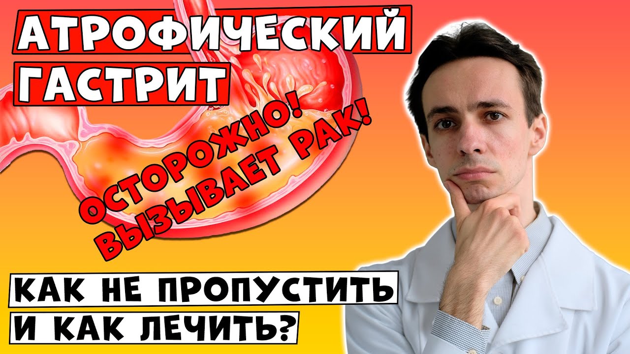 ОСТОРОЖНО! Этот вид ГАСТРИТА вызывает РАК! Атрофический гастрит. Симптомы, обследования, лечение