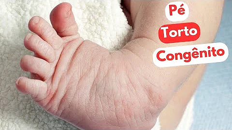 Como corrigir o pé torto?