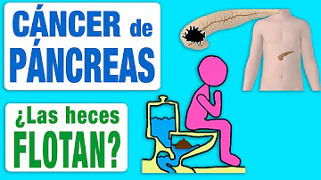 ¿Por qué flotan las cacas de mi hijo?