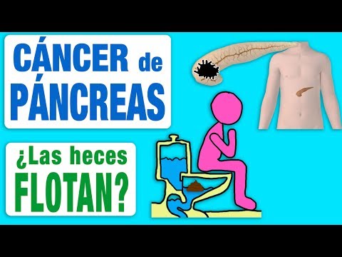 Video: ¿Qué hace que los excrementos se hundan?