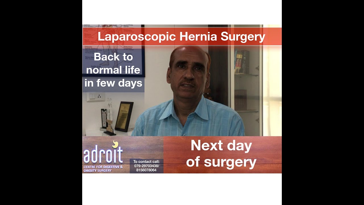 hernia surgery recovery Laparoscopic hernia surgery on both sides: Patient review