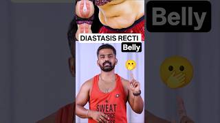 How to Fix Diastasis Recti Belly Naturally After Pregnancy