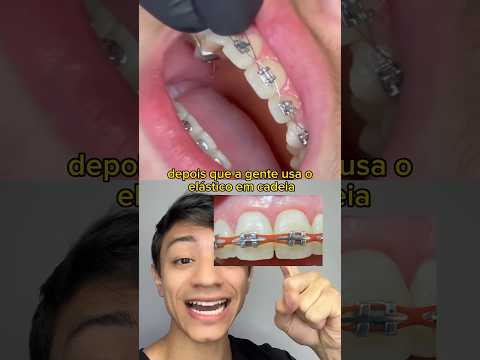 Vídeo: Como usar o fio dental: 14 etapas (com fotos)