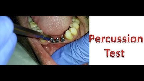 How to check implant stability for BCS implants