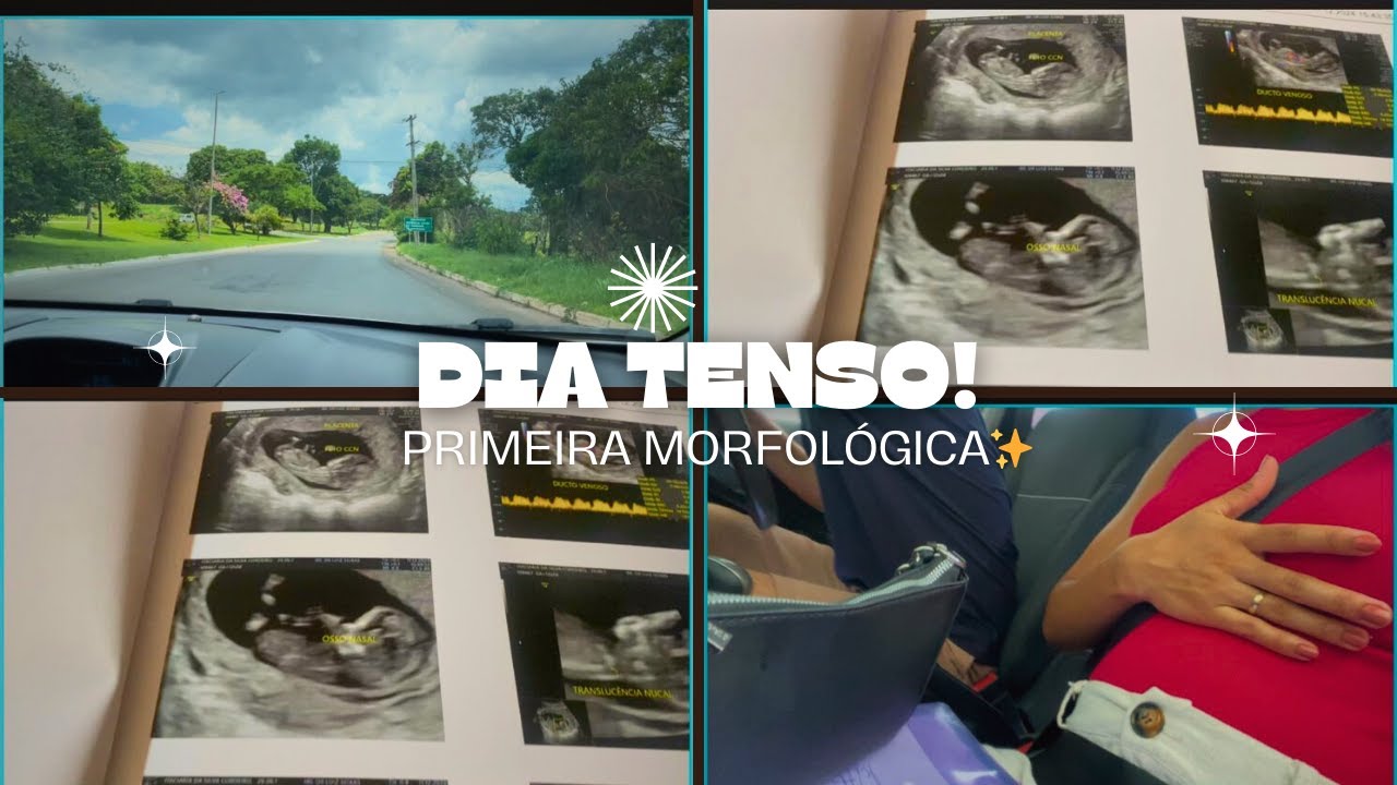 Dia Tenso! Primeira Morfológica do Caio! Exame Morfológico do Primeiro ...