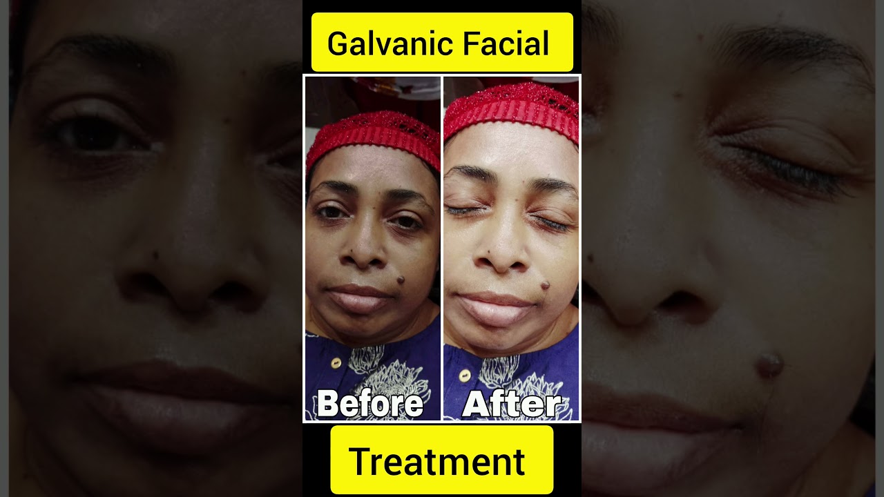 Galvanic Facial treatment 