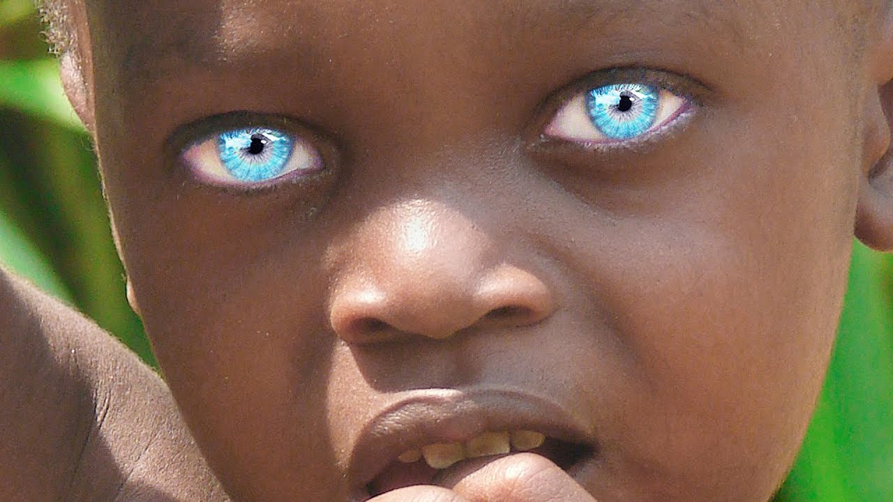 Самого редкого человека. Необычный цвет глаз. Люди с необычным цветом глаз. Самый необычный цвет глаз. Необычные голубые глаза.