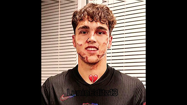 Donnarumma face injury 🤕☠️🩸 #edit #football #cubarsi #donnarumma