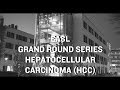 EASL Grand Round Series: Hepatocellular Carcinoma (HCC)