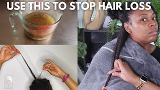 These HERBS naturally Block DHT and ReGrow Hair| Week 10 Prevent Hair Loss Challenge