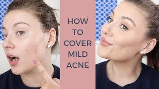 MAKE UP Tutorial for ACNE prone skin | My Everyday Make up routine ✨