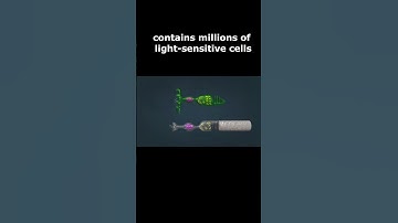 Retinal diseases  #diabeticretinopathy #eyediseases #glaucoma