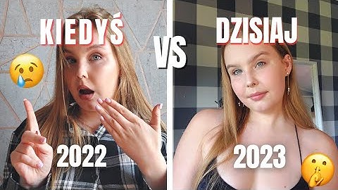 ODPOWIADAM NA TE SAME PYTANIA PO ROKU!