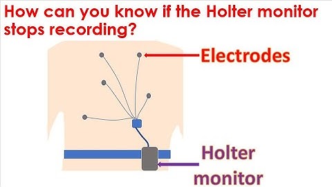 How can you know if the Holter monitor stops recording?