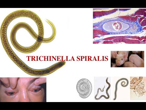 Video: ¿Qué tan común es la trichinella spiralis?
