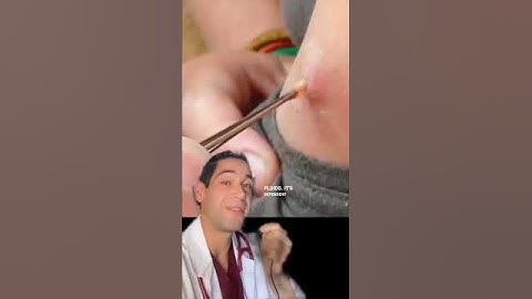 Made verwijderd met SPEK #dokter #shorts #hortfly