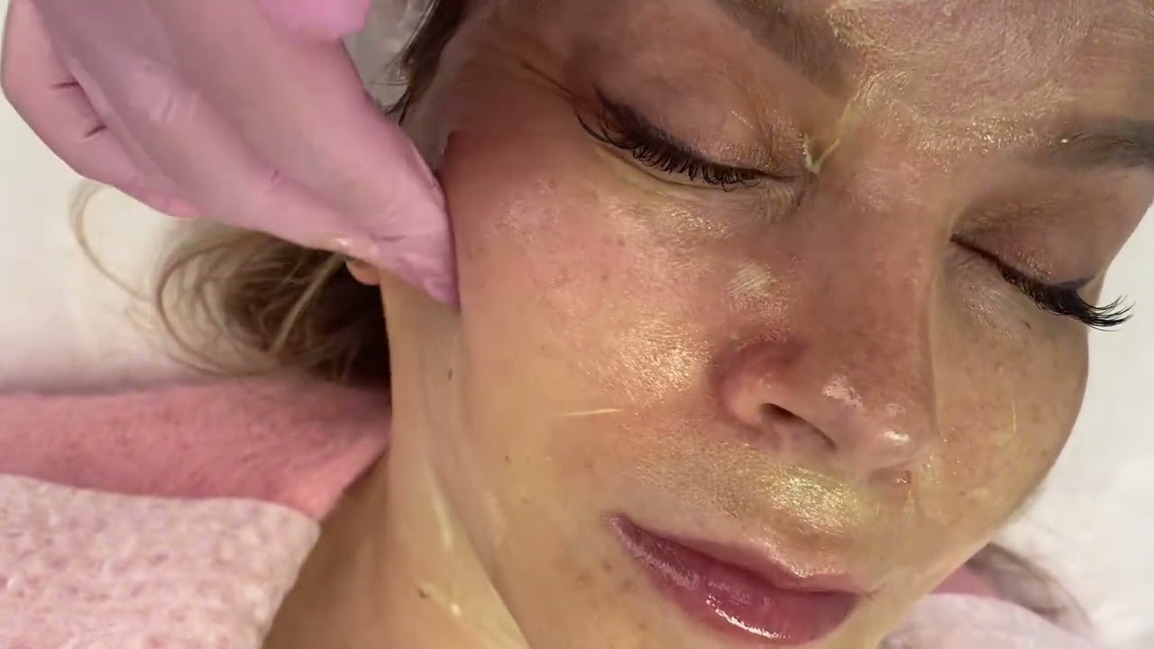 Желтый пилинг. Ретинол. Проведение процедуры на лице и на зоне шеи и декольте.