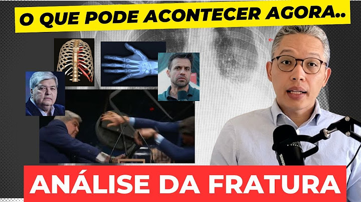 FRATURA DE COSTELA: ENTENDA OS PERIGOS POR TRÁS DESTE DANO | PABLO MARÇAL e Datenq ⚠️